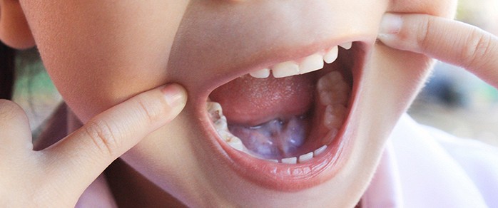 Детские зубы - 10 мифов, с которыми пора попрощаться