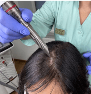 Почему важно делать аппаратное лечение волос?